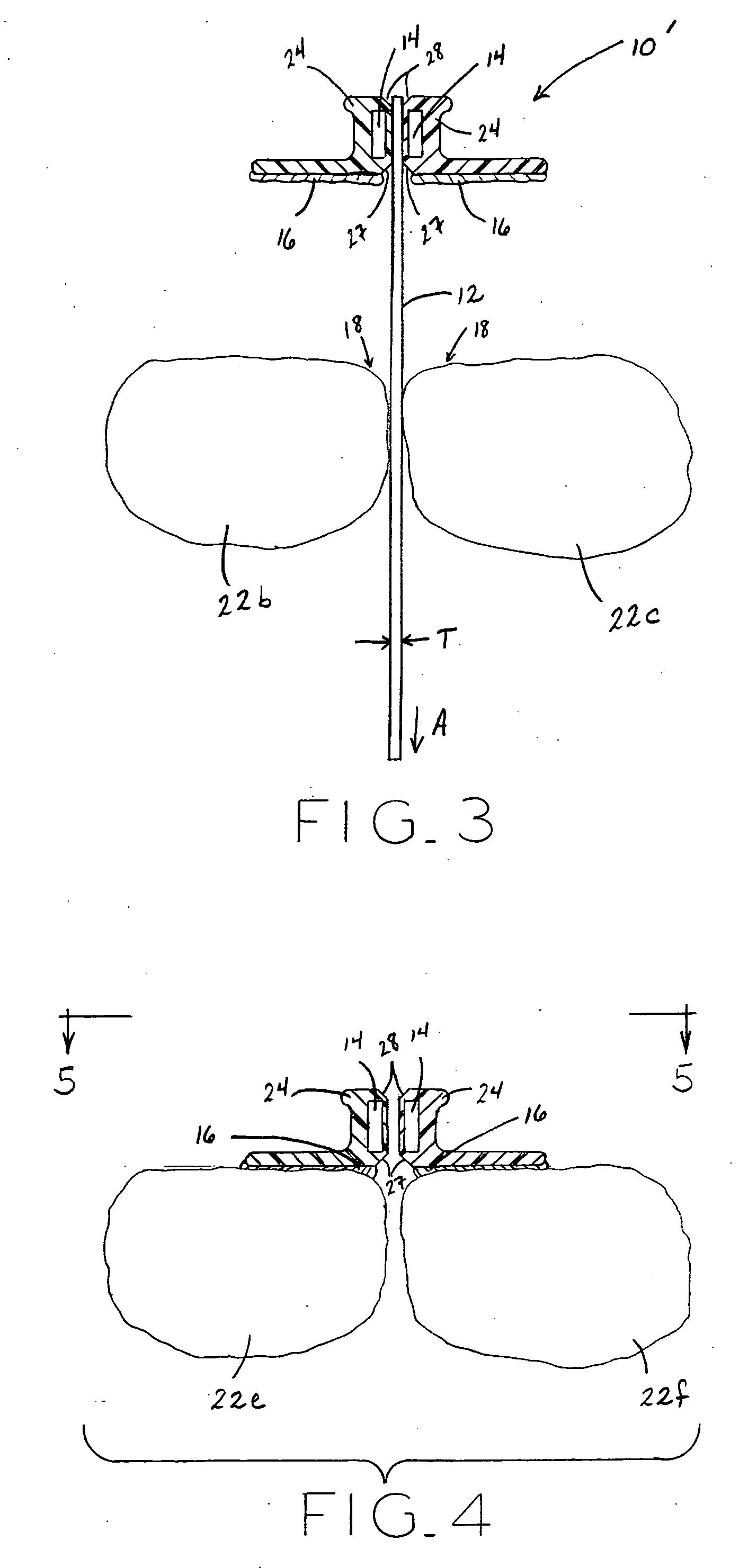 Method and apparatus for positioning an orthodontic appliance