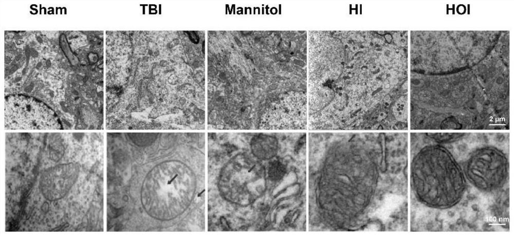 Hydrogen molecule therapeutic agents for restoring brain function after TBI injury