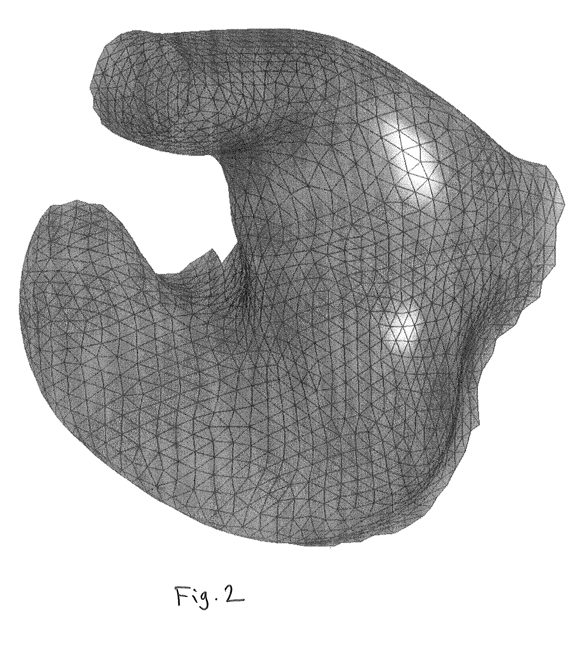 Method for estimating the shape of an individual ear