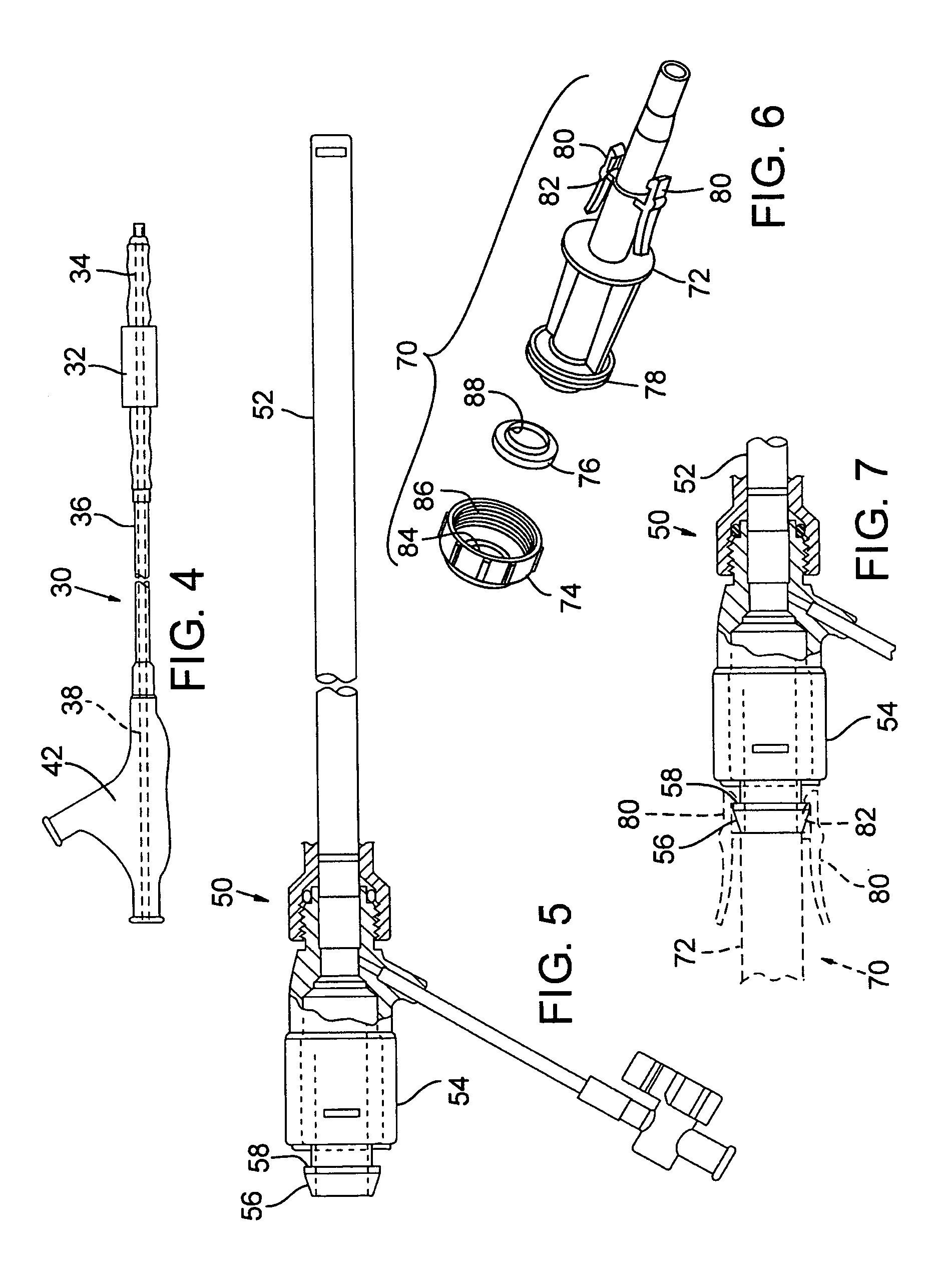 System for percutaneous delivery and removal of a prosthetic valve