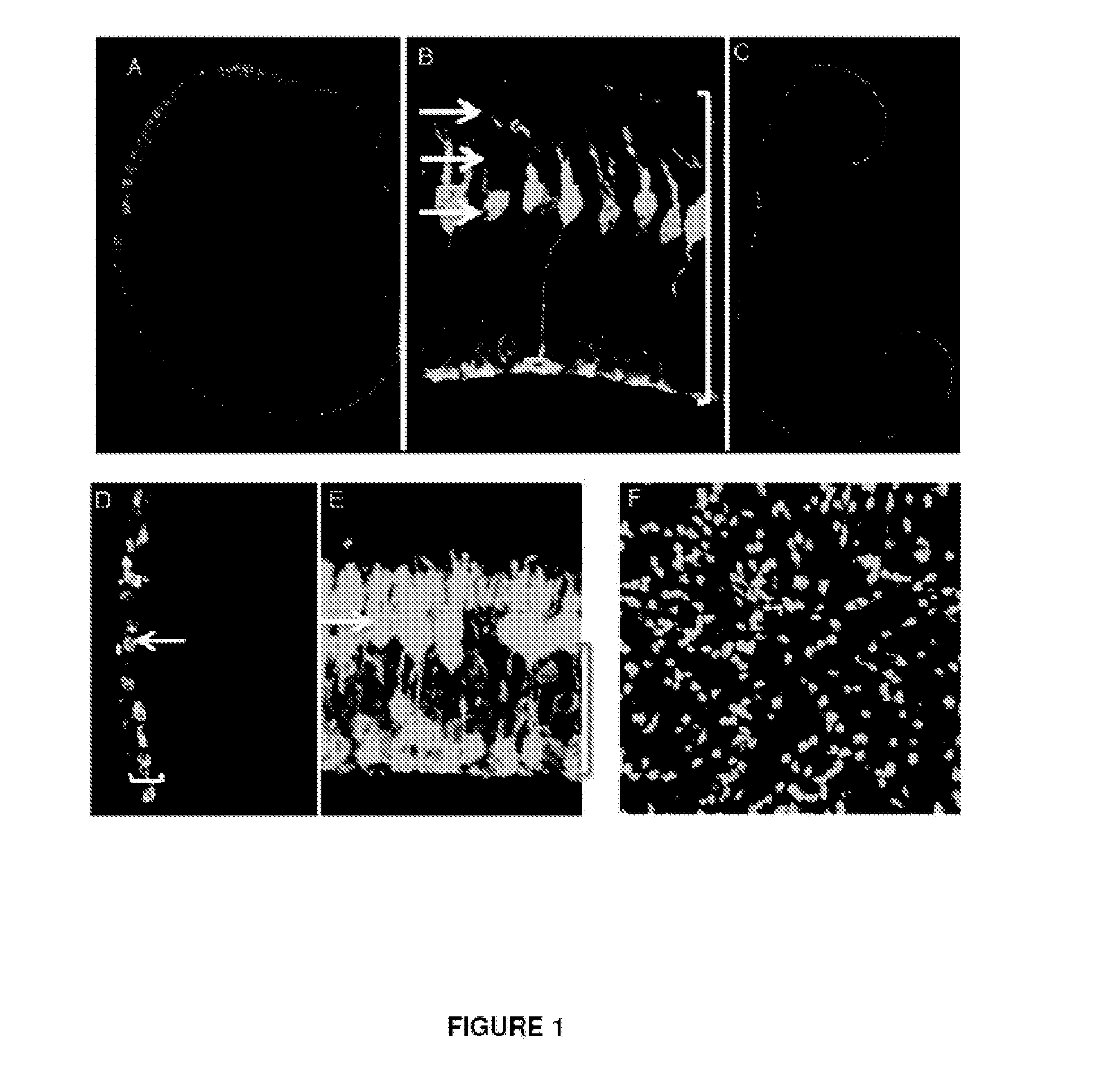 Histone deacetylase compositions and uses thereof