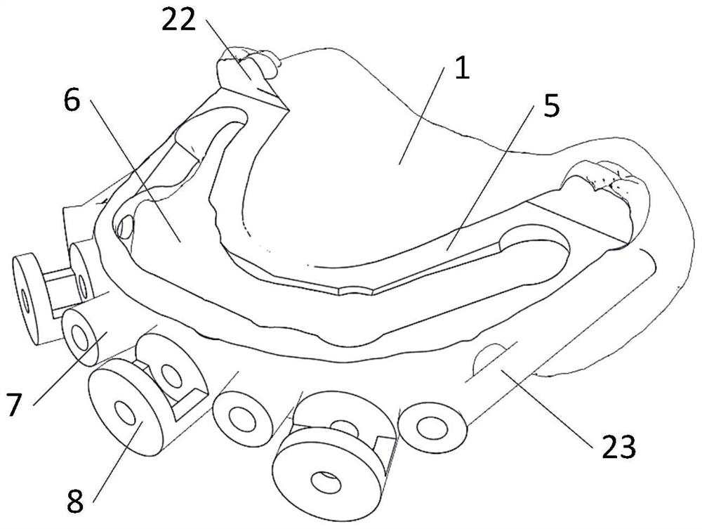 Novel combined guide plate