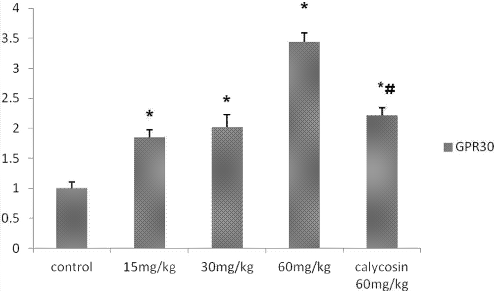 Application of calycosin derivative in preparing medicine for treating cerebral ischemia reperfusion injury