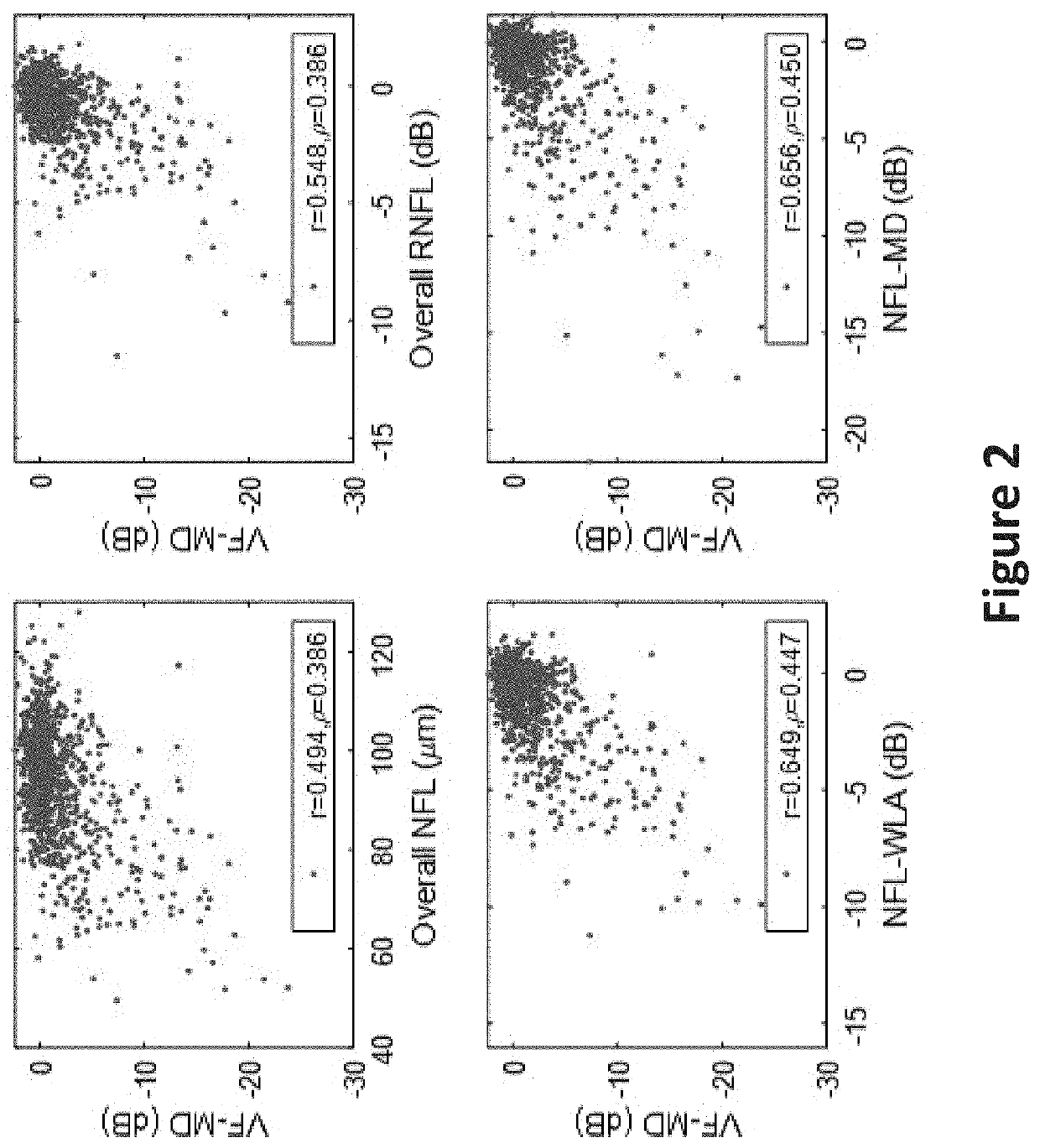 Visual field simulation using optical coherence tomography and optical coherence tomographic angiography