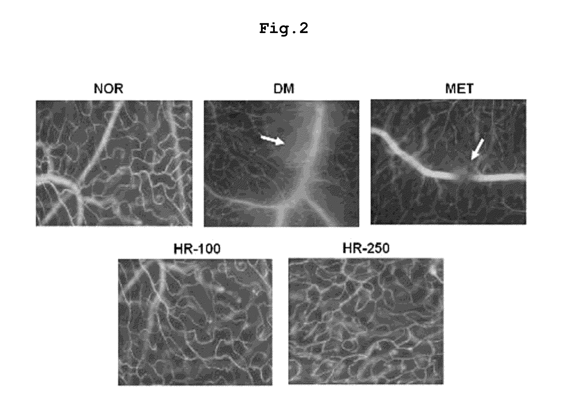 Pharmaceutical composition for preventing and treating complications of diabetes containing a traditional oriental medicine extract or a fraction thereof as an active ingredient