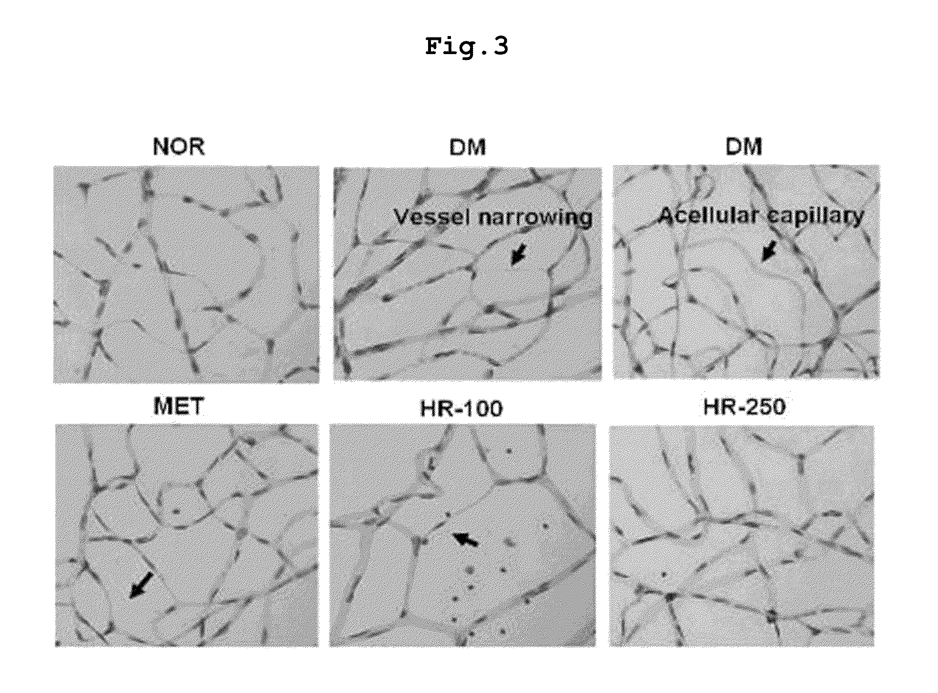 Pharmaceutical composition for preventing and treating complications of diabetes containing a traditional oriental medicine extract or a fraction thereof as an active ingredient