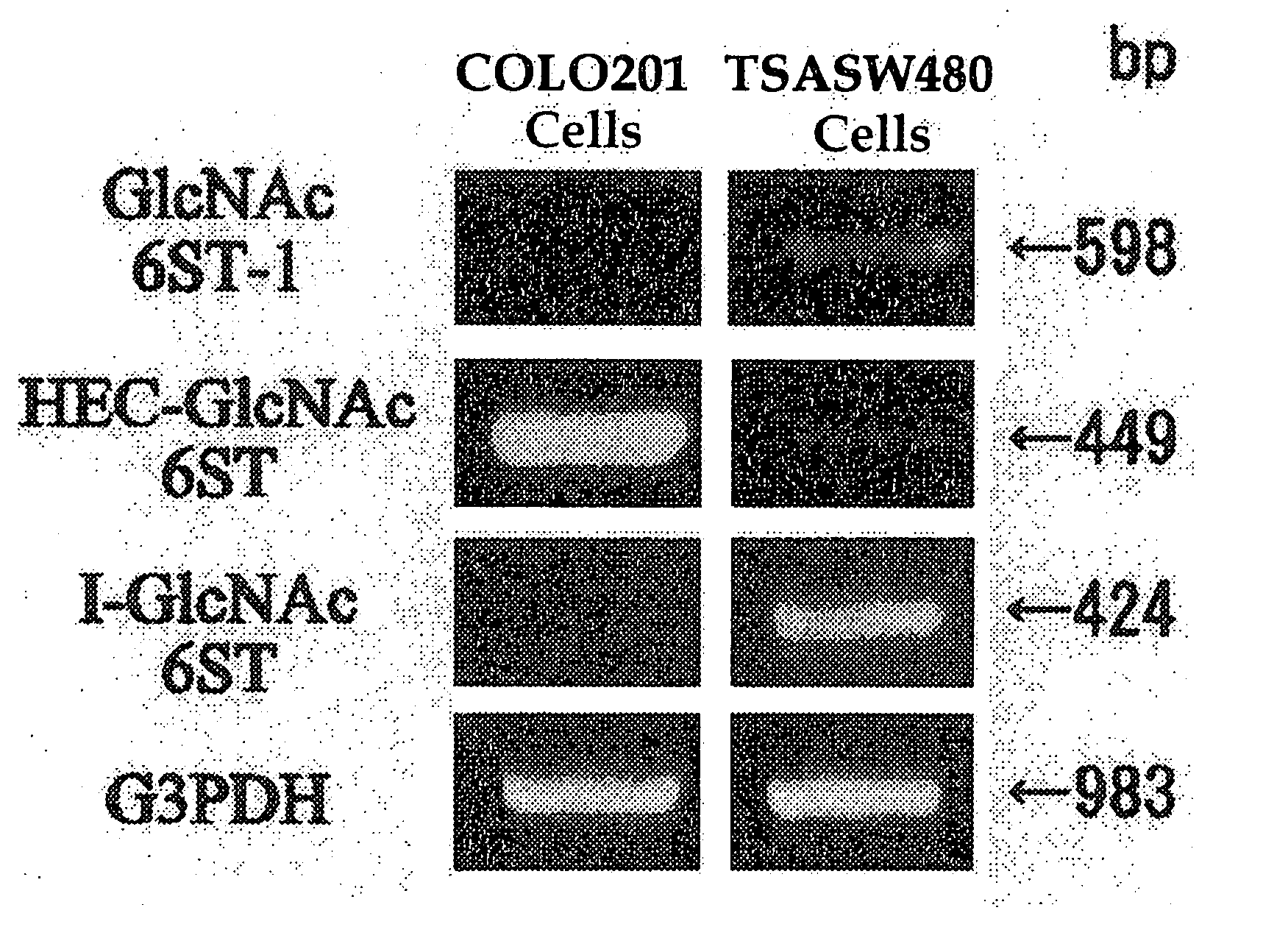 Method For Examining Carcinoma And Adenoma