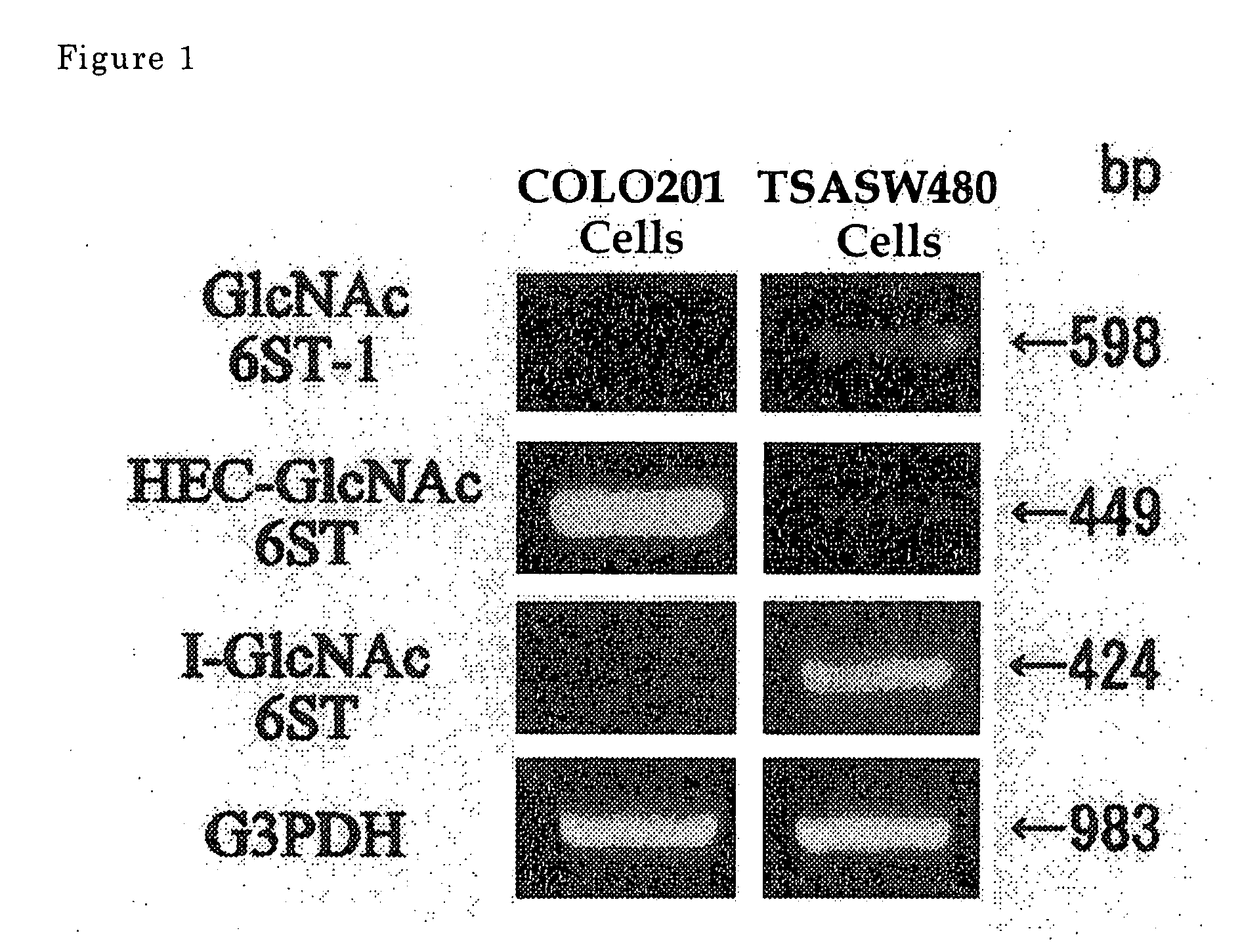 Method For Examining Carcinoma And Adenoma