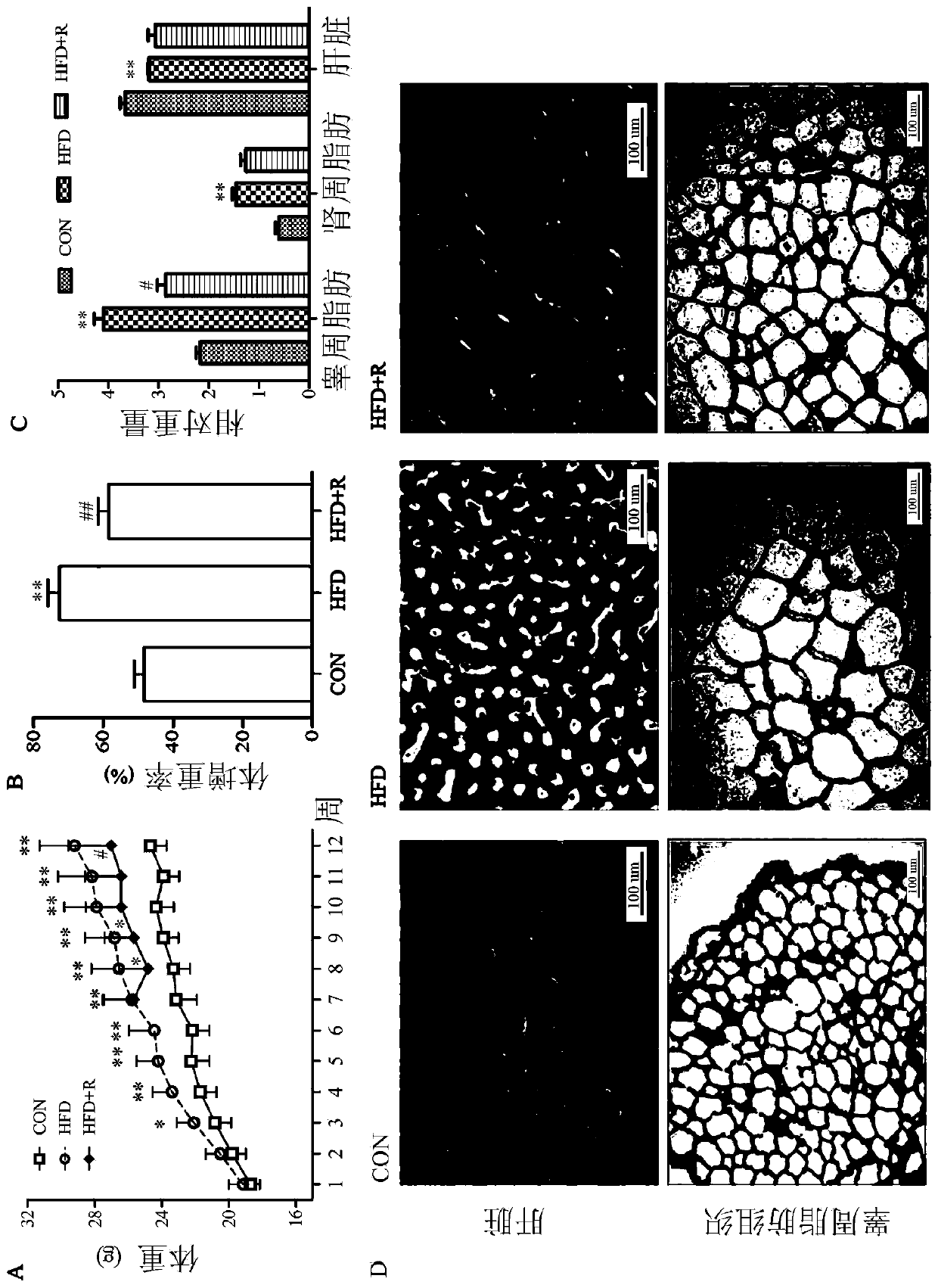 Application of a breast milk-derived Lactobacillus reuteri in reducing lipids and regulating lipid metabolism rhythm