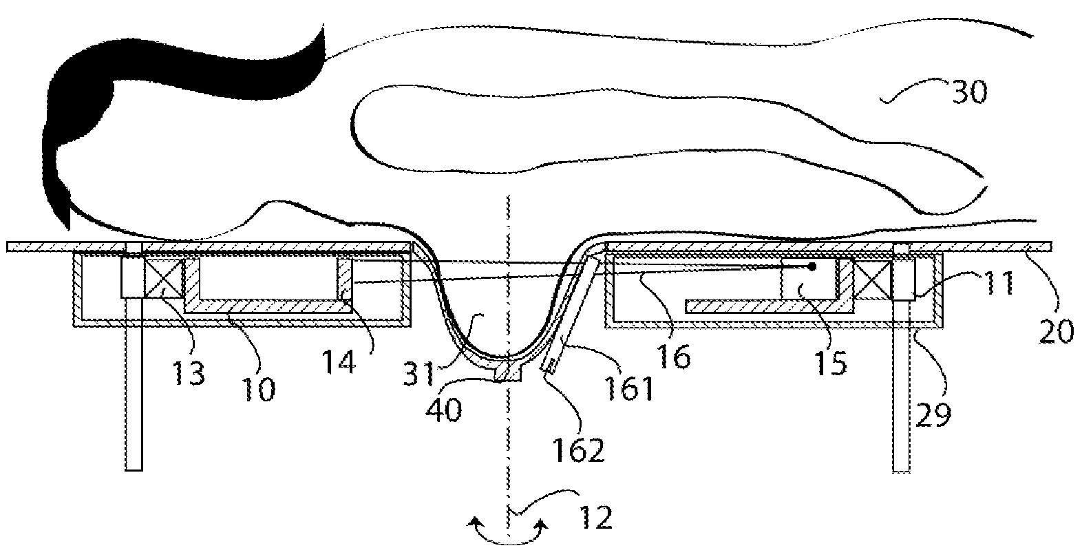 Method and Device for Thermal Breast Tumor Treatment with 3D Monitoring Function