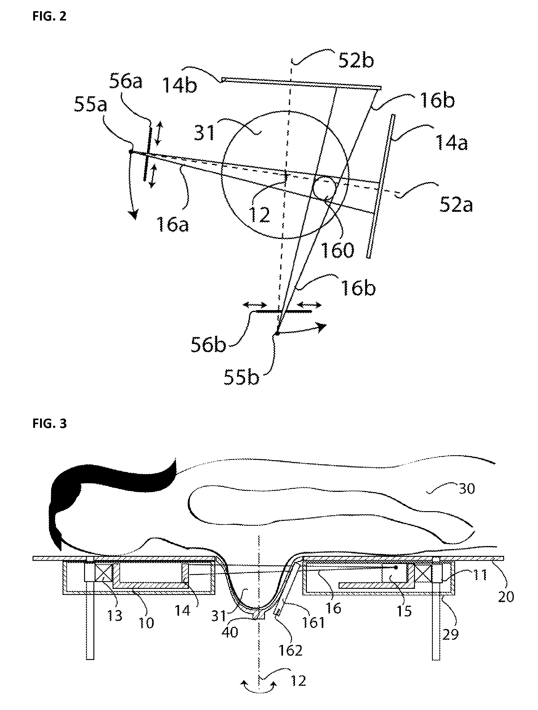 Method and Device for Thermal Breast Tumor Treatment with 3D Monitoring Function