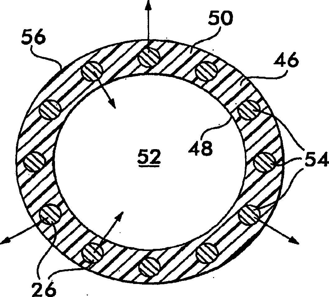Implantable shunt or catheter enabling gradual delivery of therapeutic agents