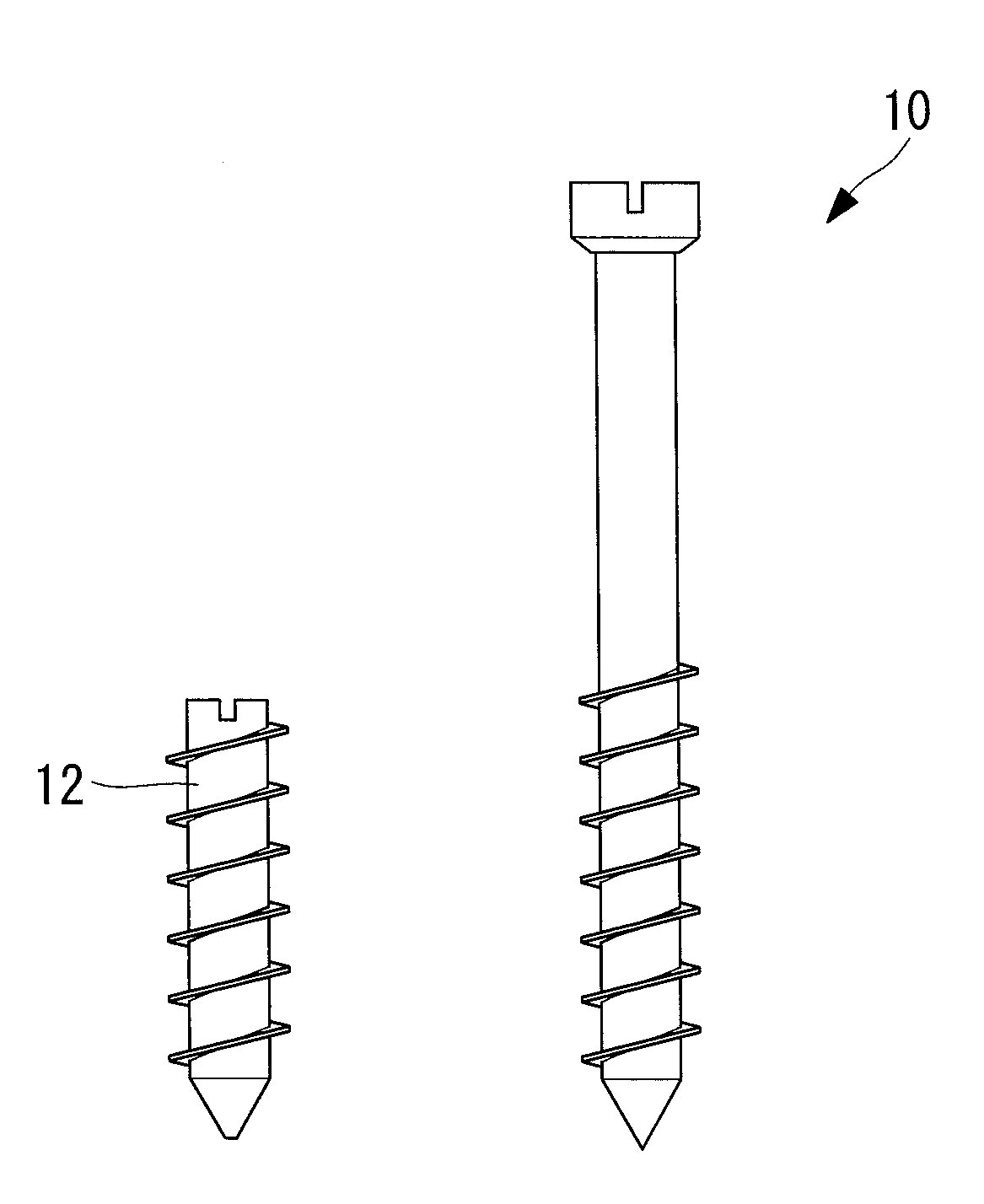 Biodegradable implant and fabrication method thereof