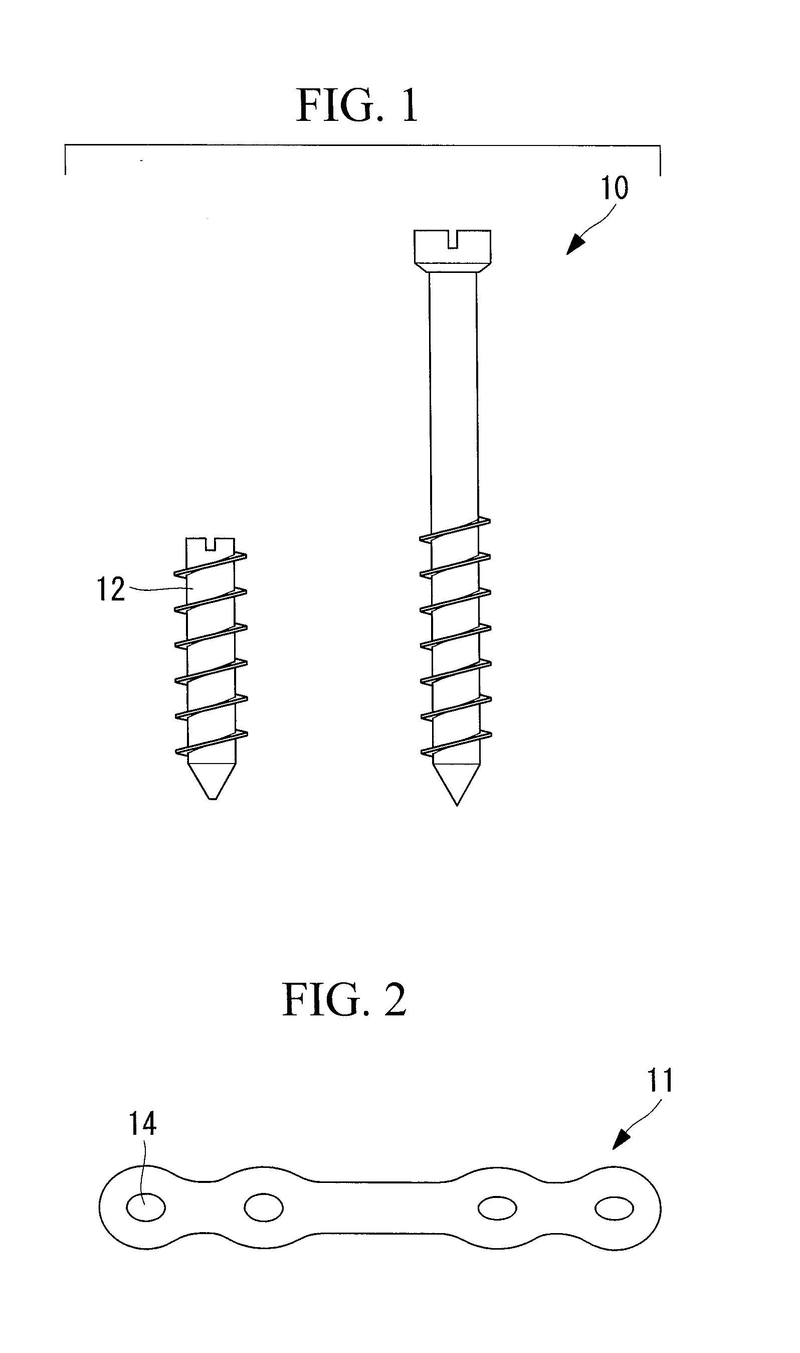 Biodegradable implant and fabrication method thereof