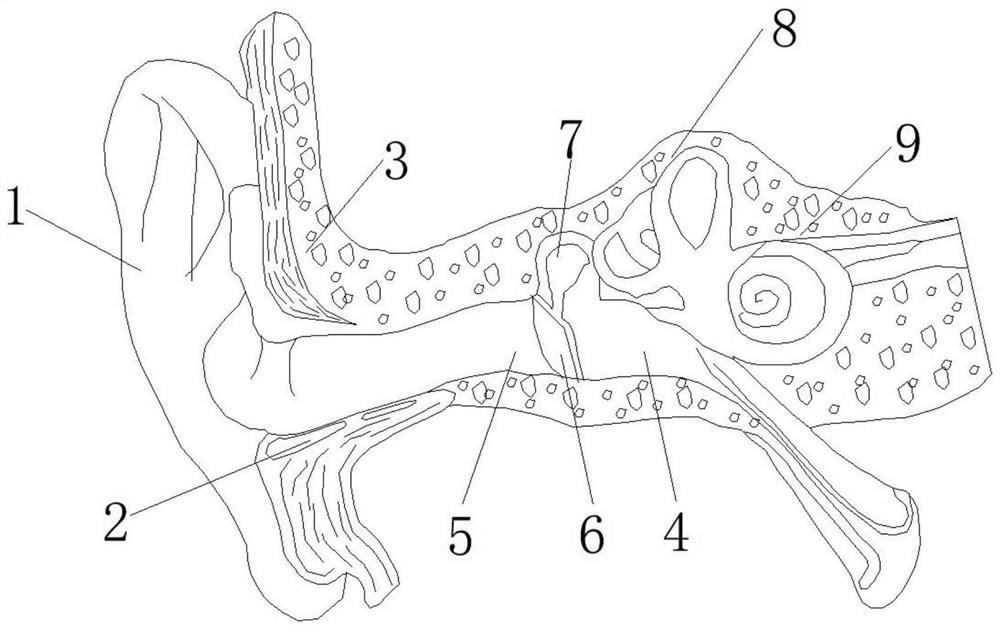 Test method for optimizing hearing reconstruction scheme by adopting simulation mold