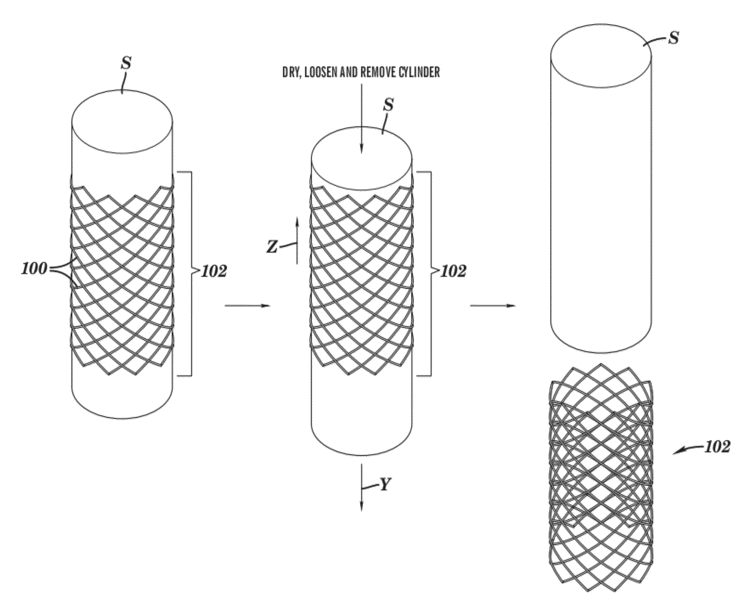 Stents and methods of making stents