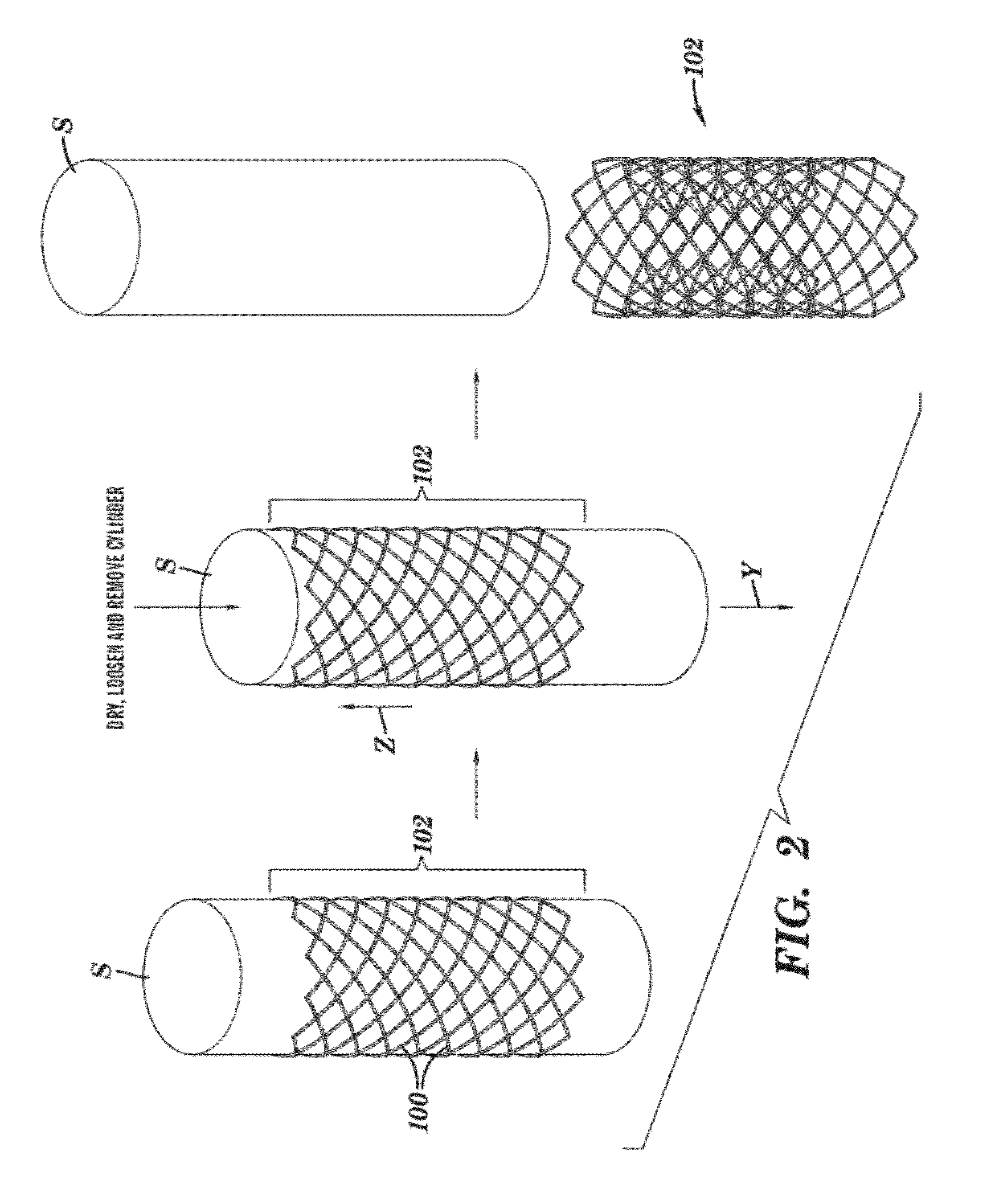 Stents and methods of making stents