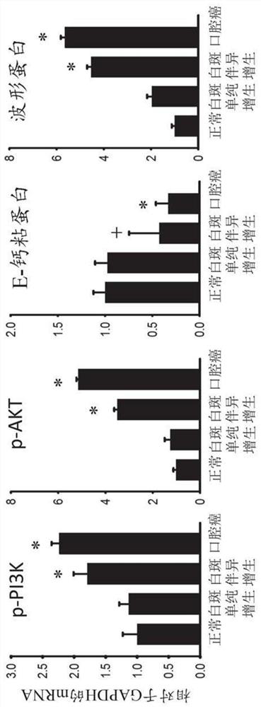 A new way to diagnose and monitor oral cancer