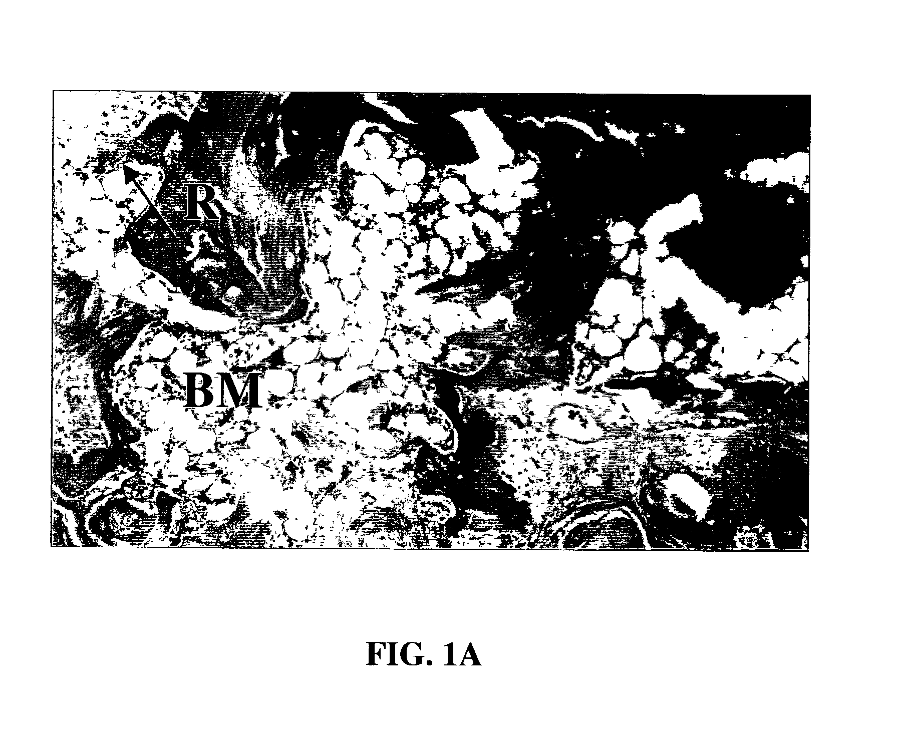 Tissue repair compositions and methods for their manufacture and use