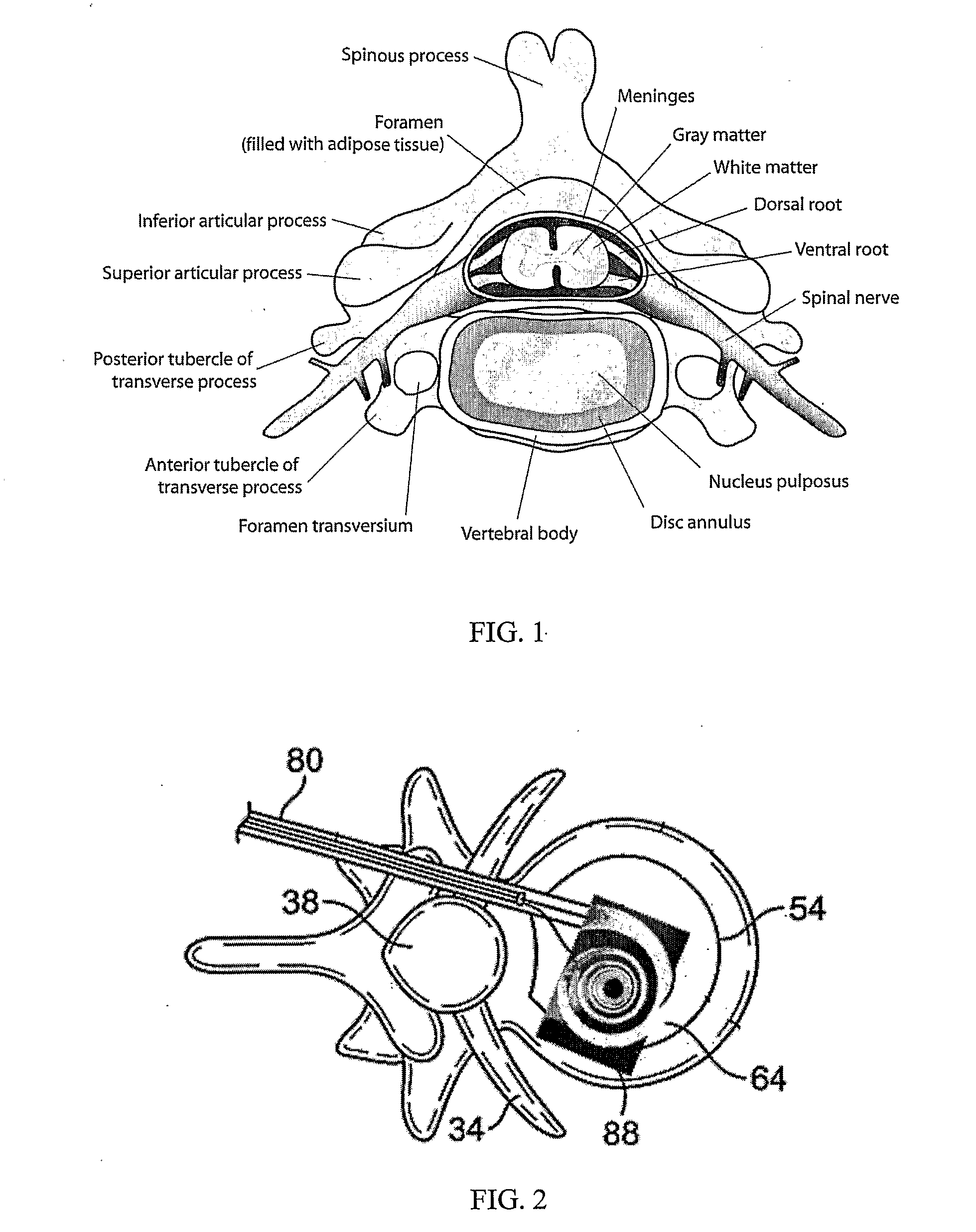 Restorative device