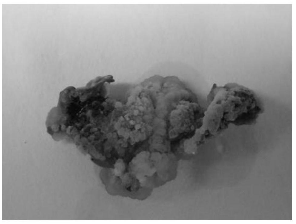 Method for inducing in-vitro leaf somatic embryo of Populus*euramericana Neva