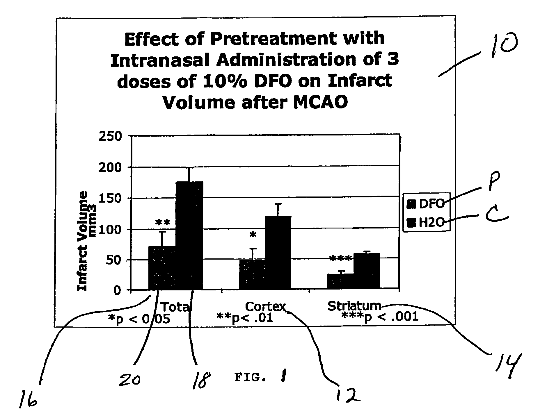 Method of treating Alzheimer's disease comprising administering deferoxamine (DFO) to the upper one-third of the nasal cavity