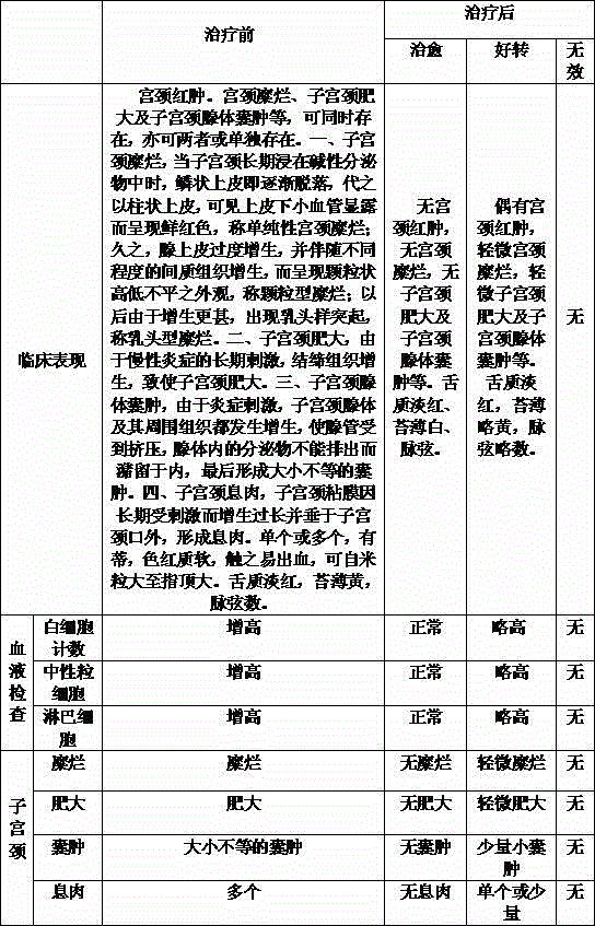 Preparation method of Chinese medicine irrigation solution for treating inflamed cervix type chronic cervicitis