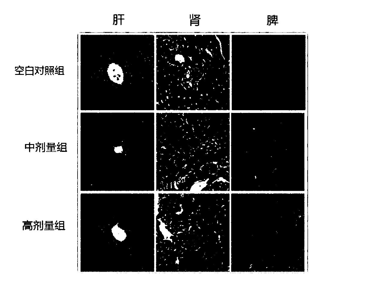 Application of 2,5-furan dimethanol in preparing antitumor drugs