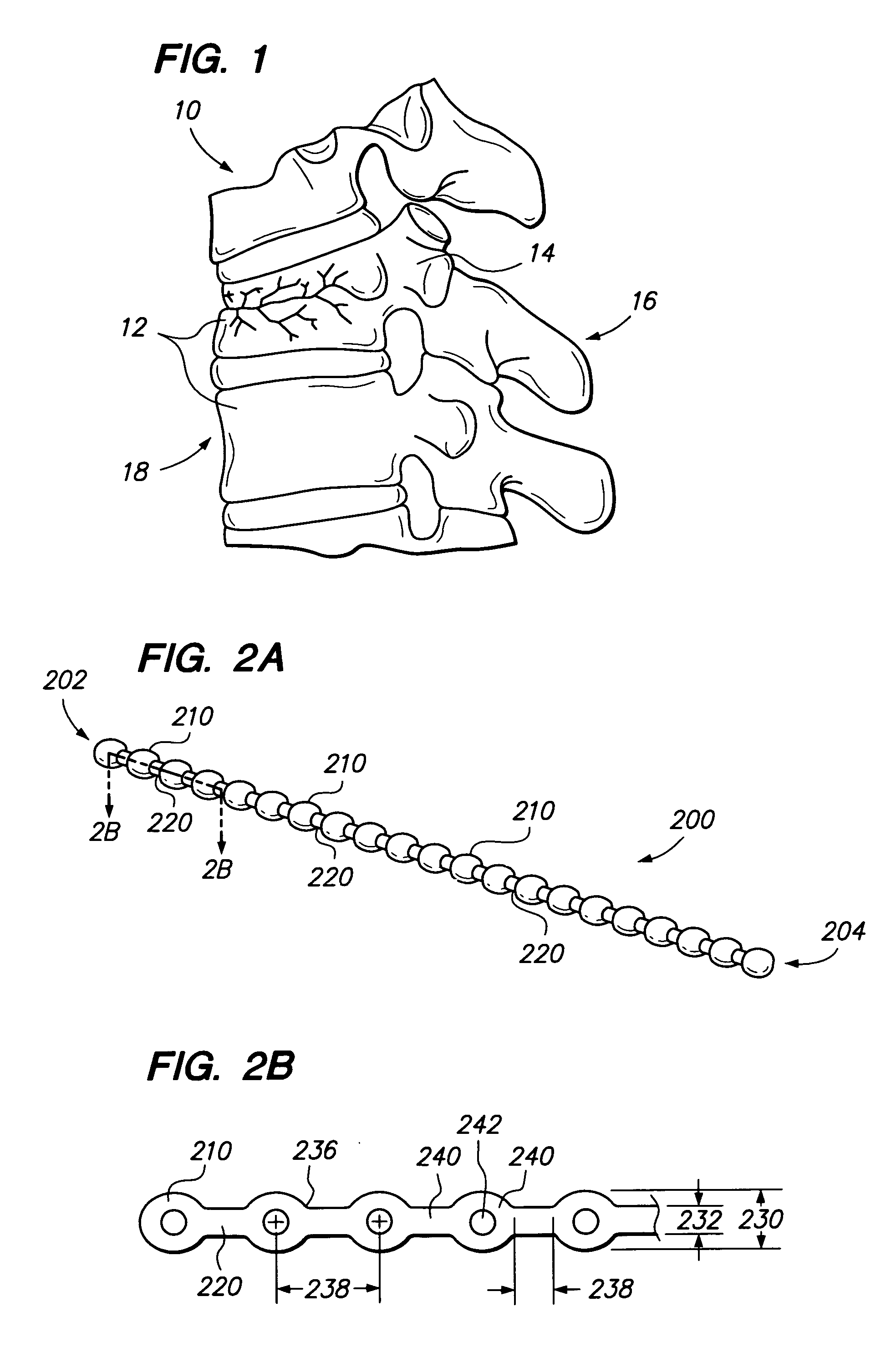 Flexible elongated chain implant and method of supporting body tissue with same