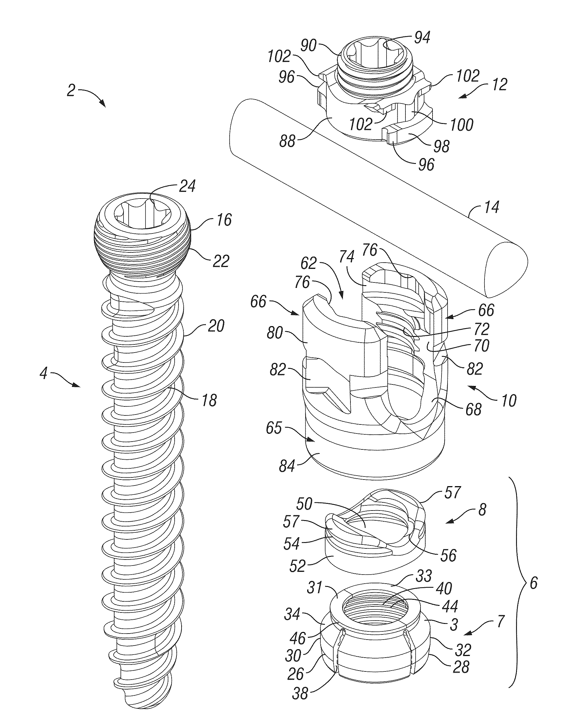 Orthopedic fixation devices and methods of installation thereof