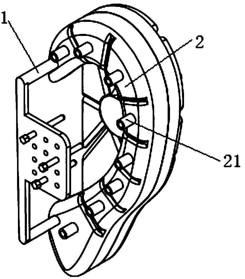 Pressure device for treating keloids of outer auricles