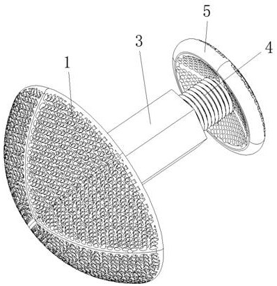 Orthopedic implant product and use method thereof