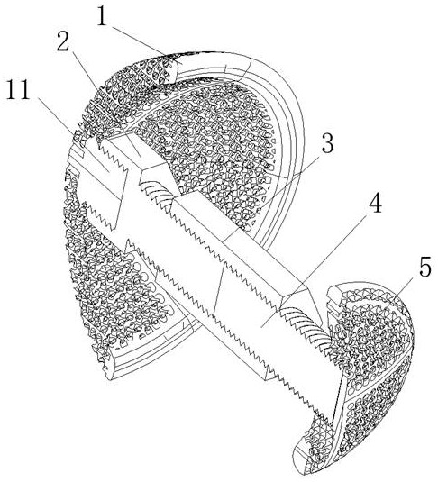 Orthopedic implant product and use method thereof