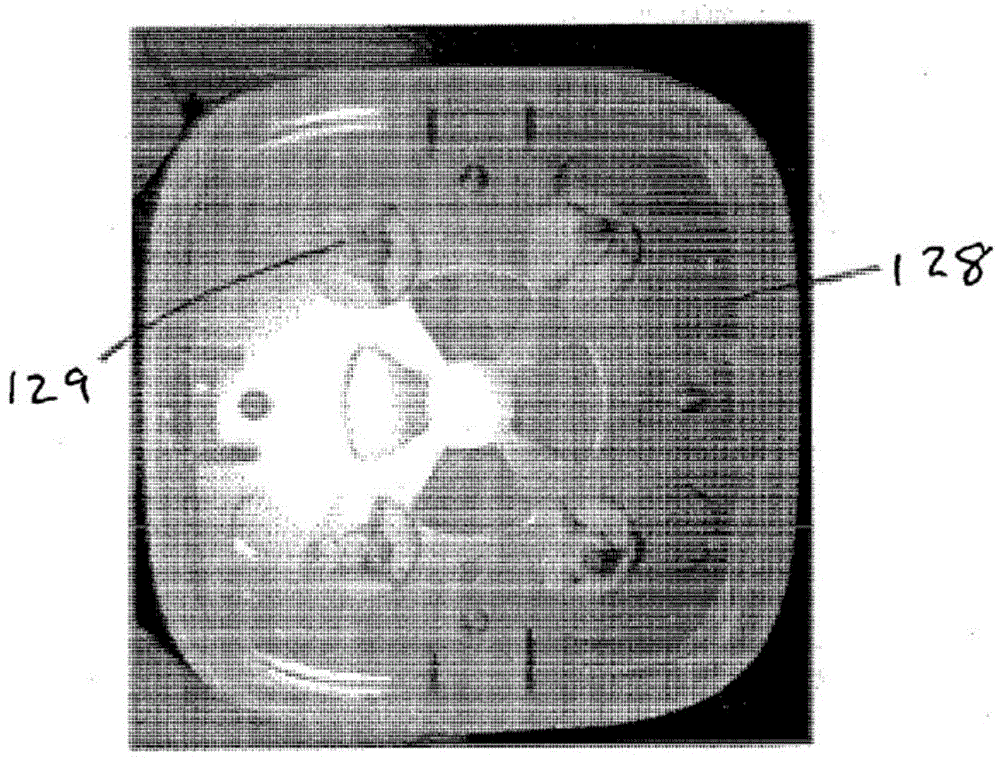 Apparatus and method for tissue rejuvenation