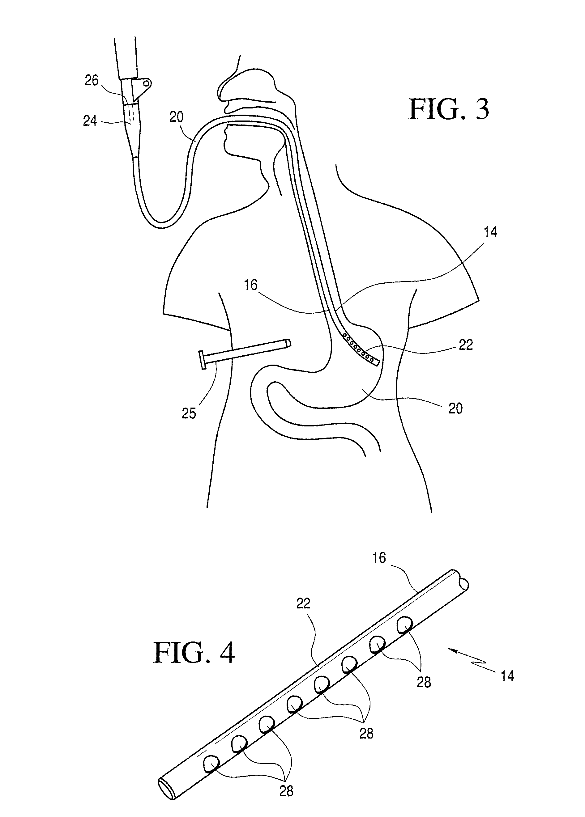 Method of rolling stomach tissue so as to maximize the contact surface area of a fold