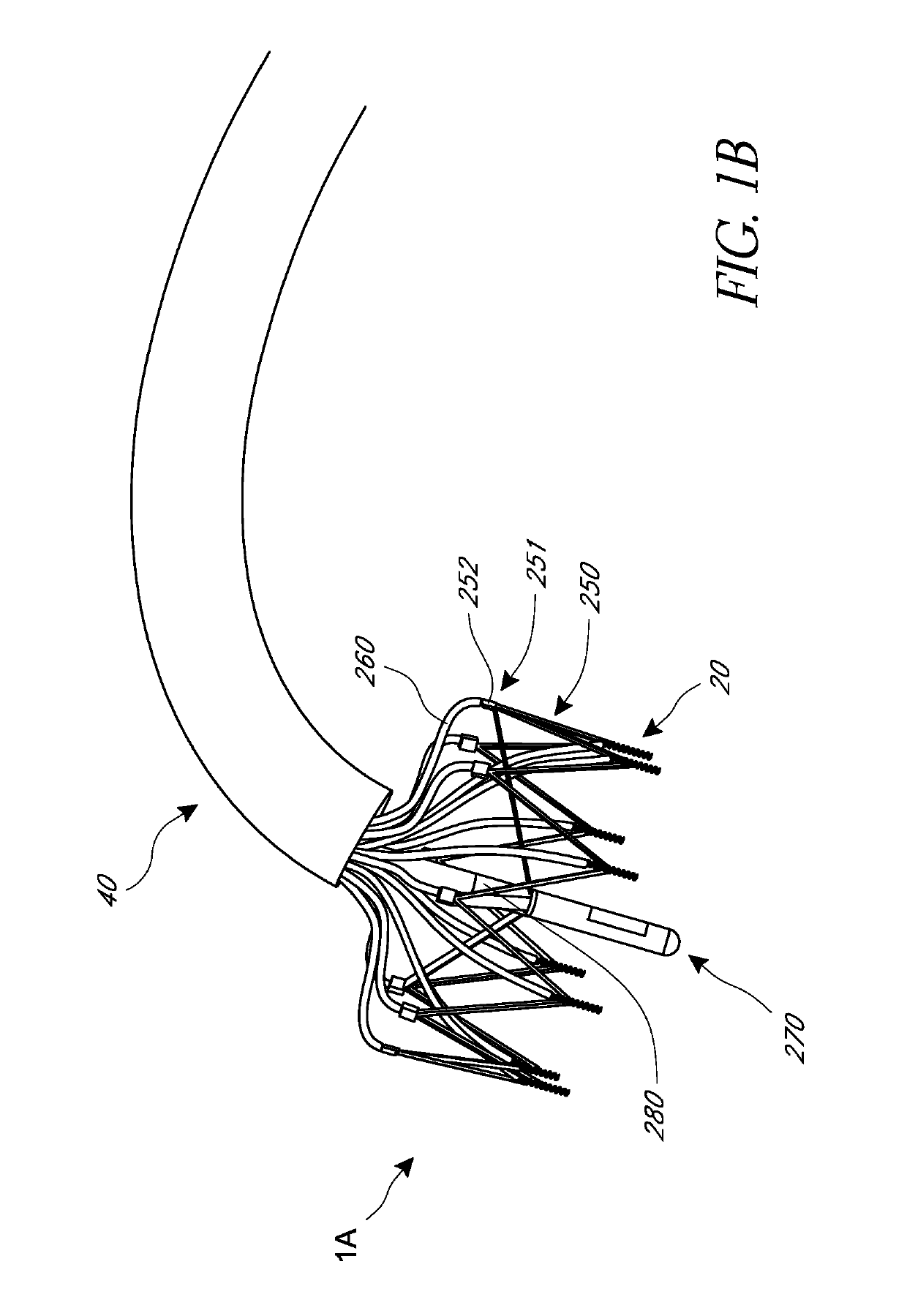 Methods for delivery of heart valve devices using intravascular ultrasound imaging