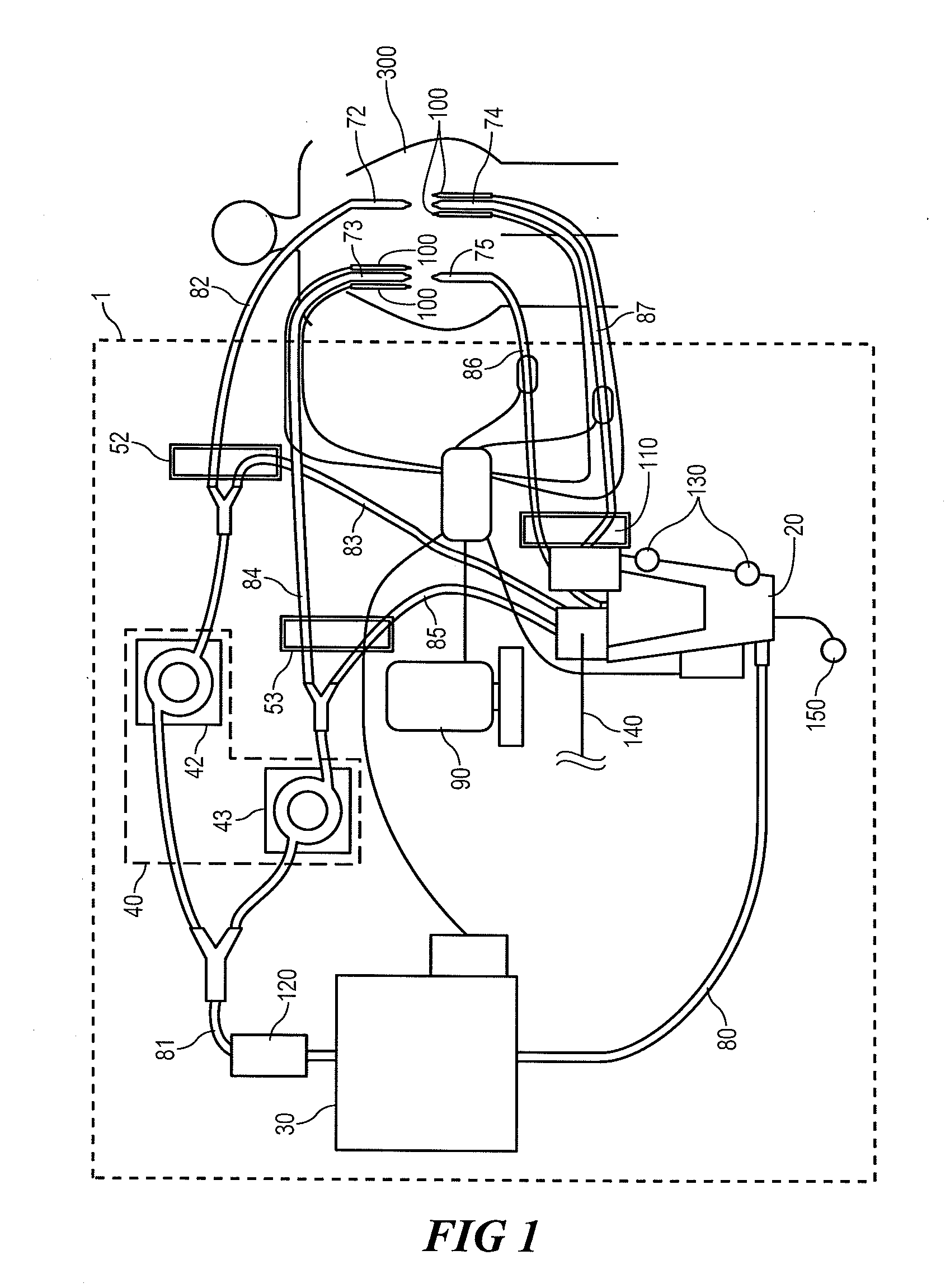 System For Chemohyperthermia Treatment