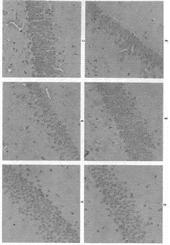 Application of butylphthalide or its derivatives in preparation of drugs for treating radiation-induced brain injury