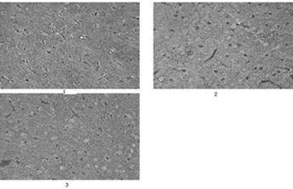 Application of butylphthalide or its derivatives in preparation of drugs for treating radiation-induced brain injury