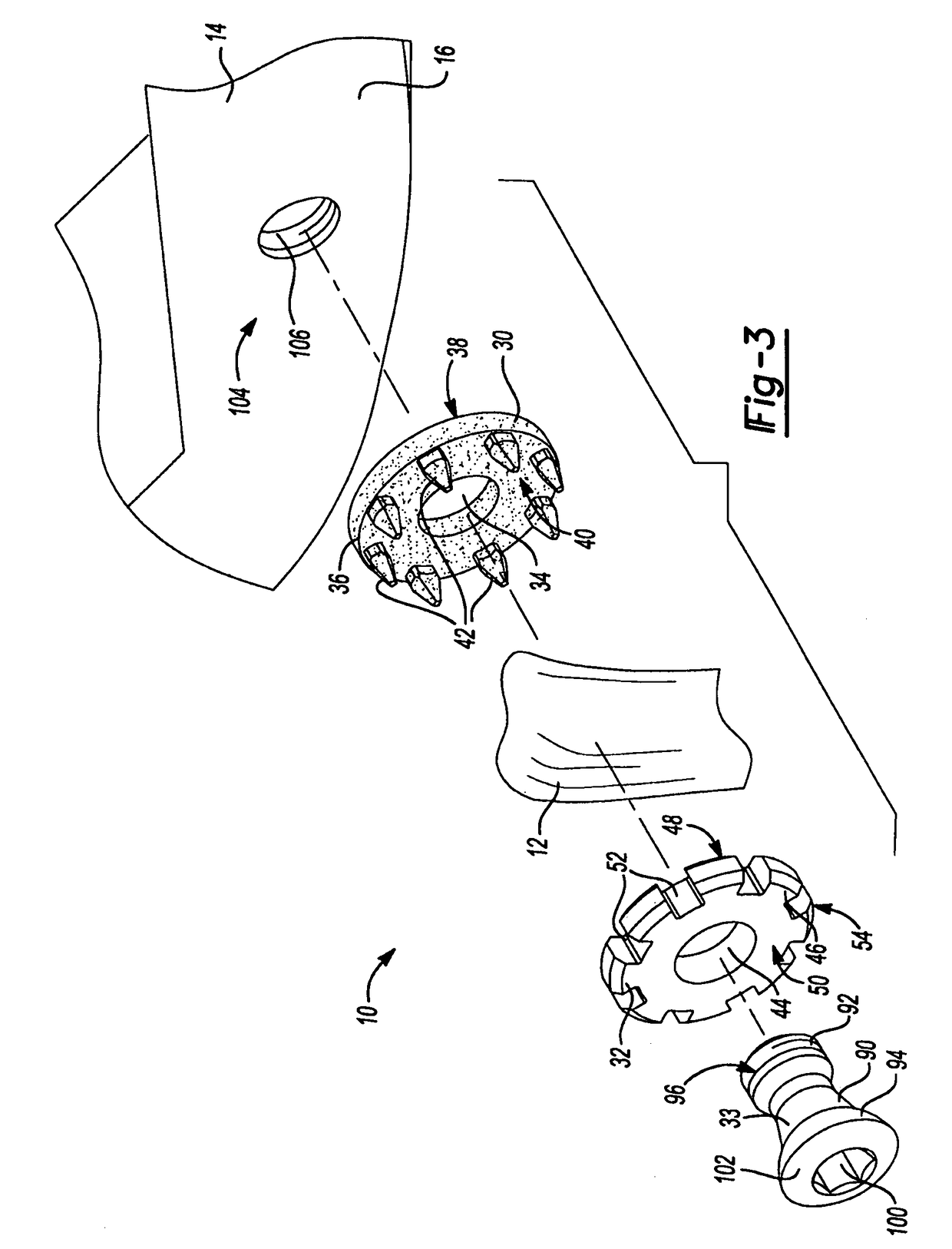 Method and apparatus for attaching soft tissue to an implant