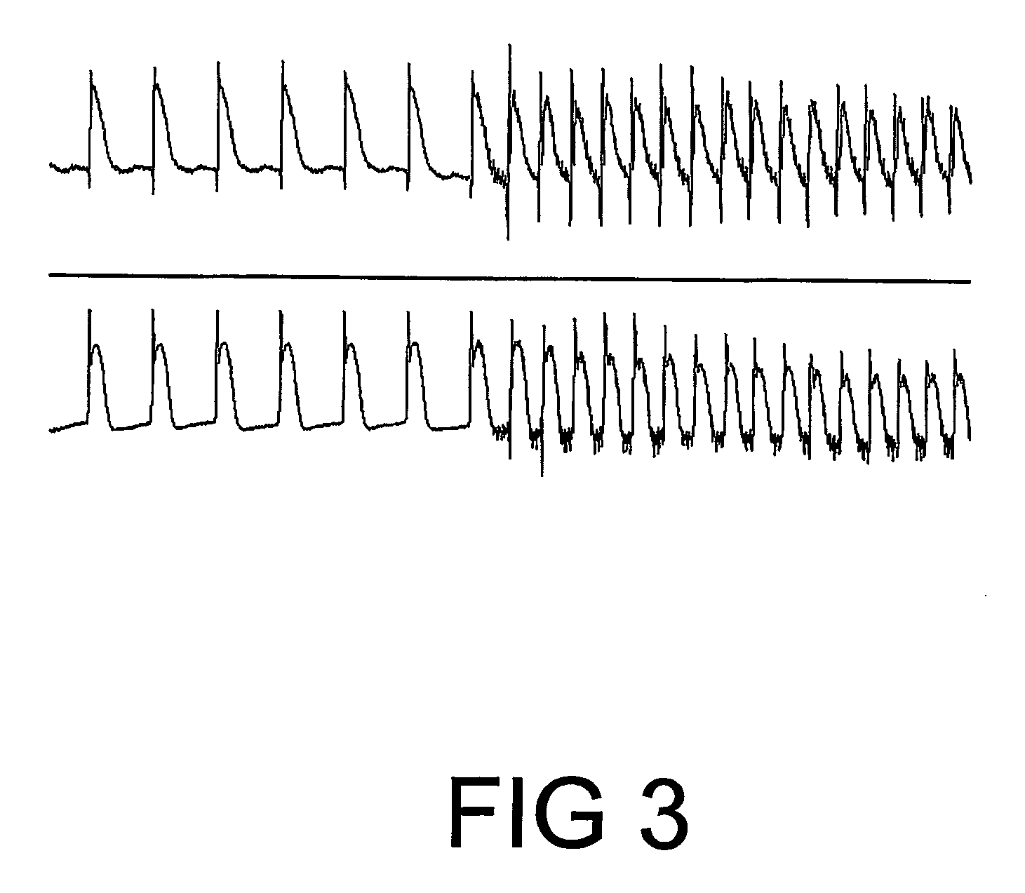 Pharmeceutical composition comprising plant material or trichilia sp. alone or in association with other plant extracts for the reversion/combat and/or prevention of ventricular fibrillation