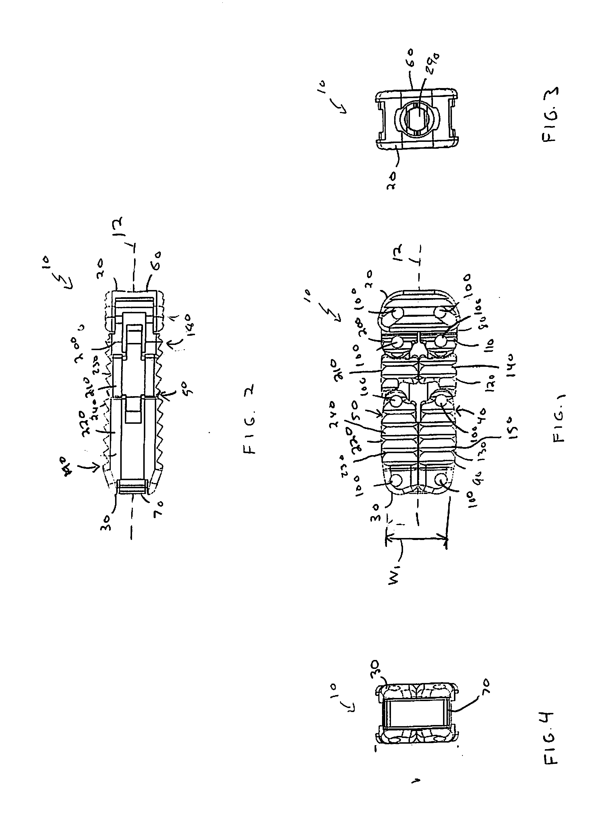 Expandable Interbody Spacer