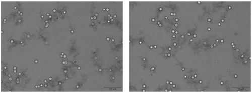 Method for quickly separating liver cells in portal area and central vein area from liver