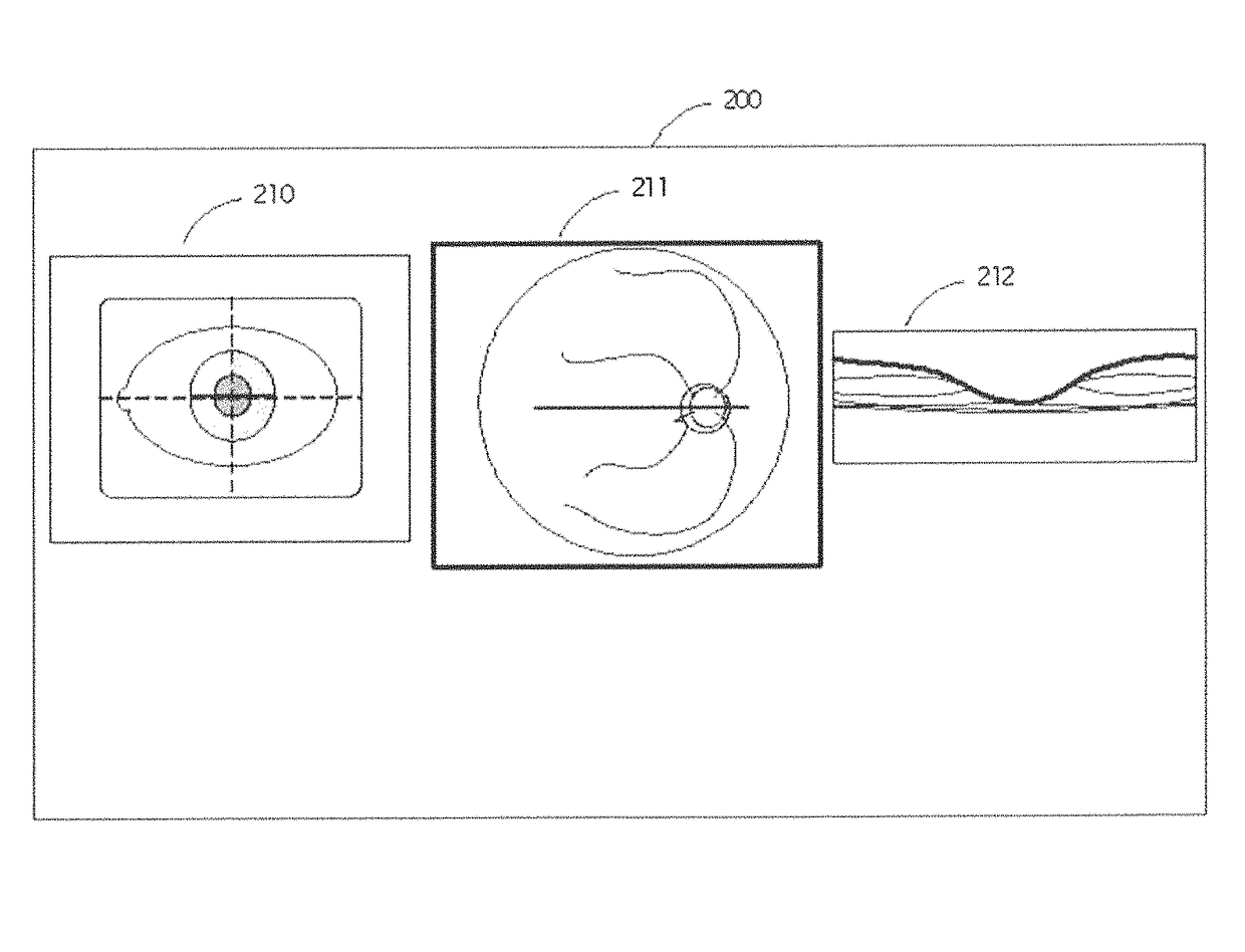 Retinal movement tracking in optical coherence tomography