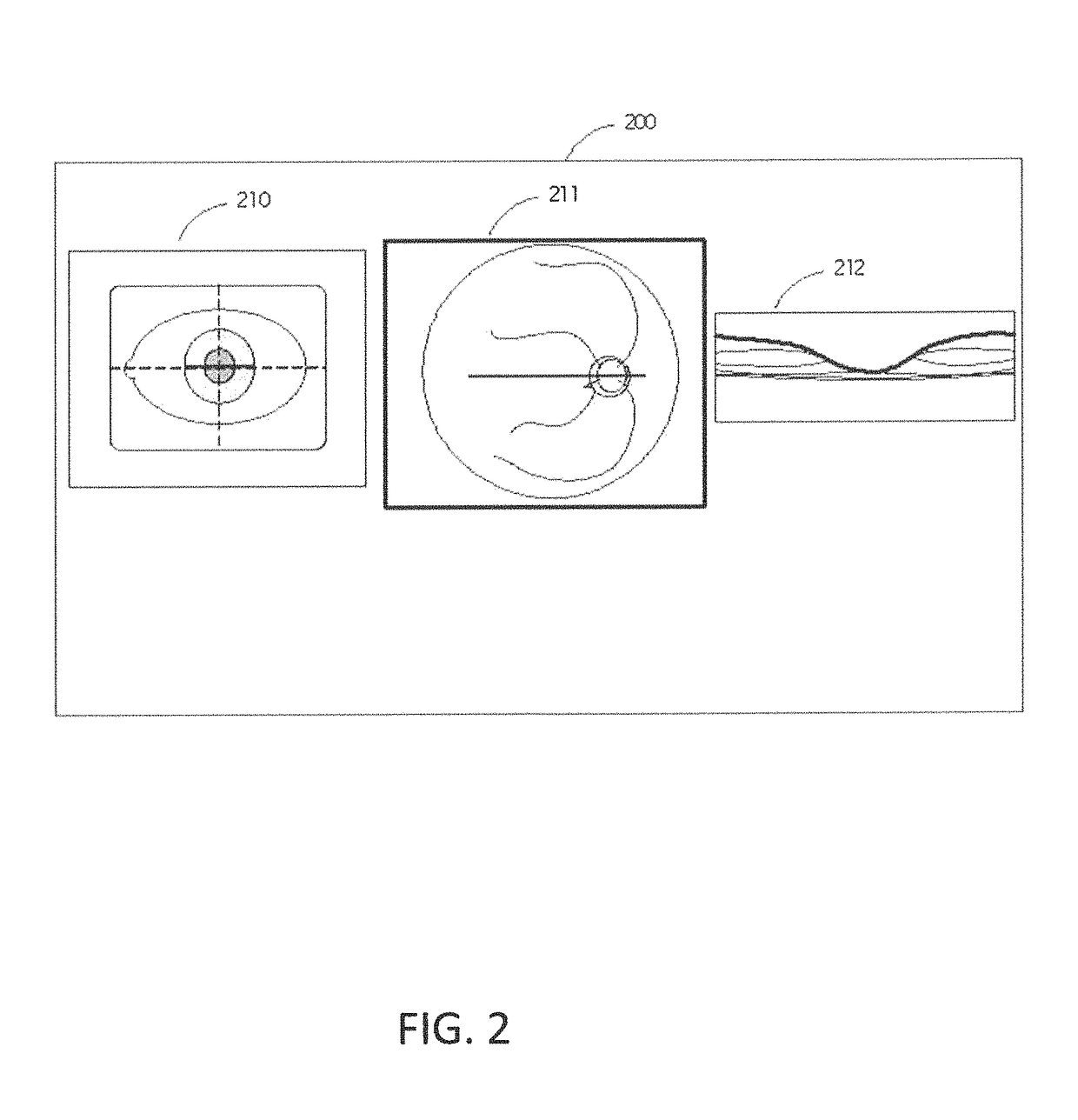 Retinal movement tracking in optical coherence tomography