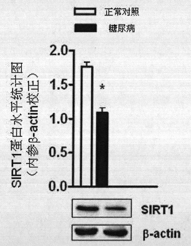 Use of SIRT1 in preparation of drugs for prevention of diseases caused by endothelial dysfunction
