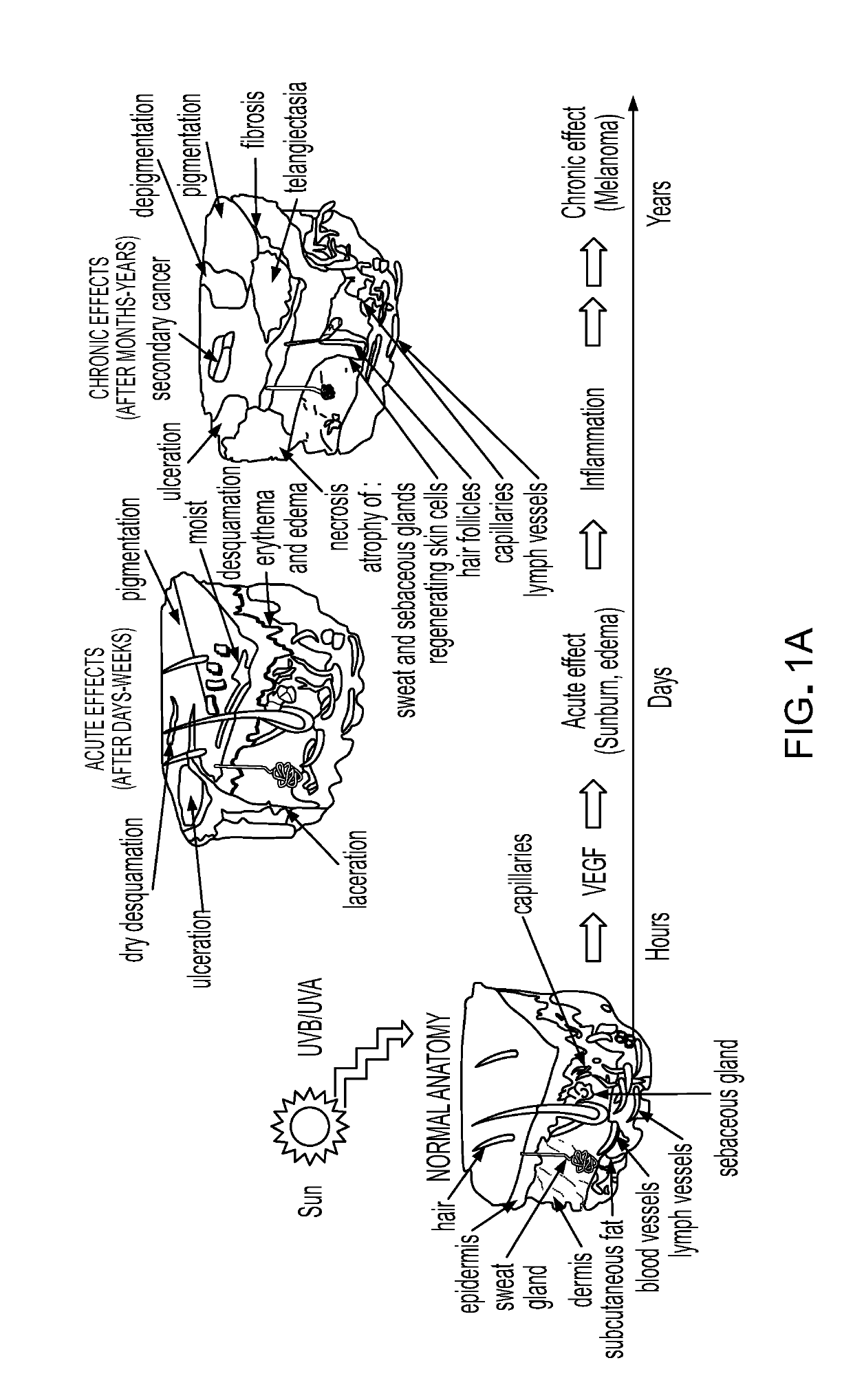 Compositions to treat ultraviolet (UV)-induced skin injury