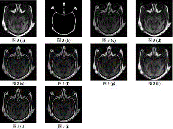 Self-adaptive multi-strategy image fusion method based on riemannian metric