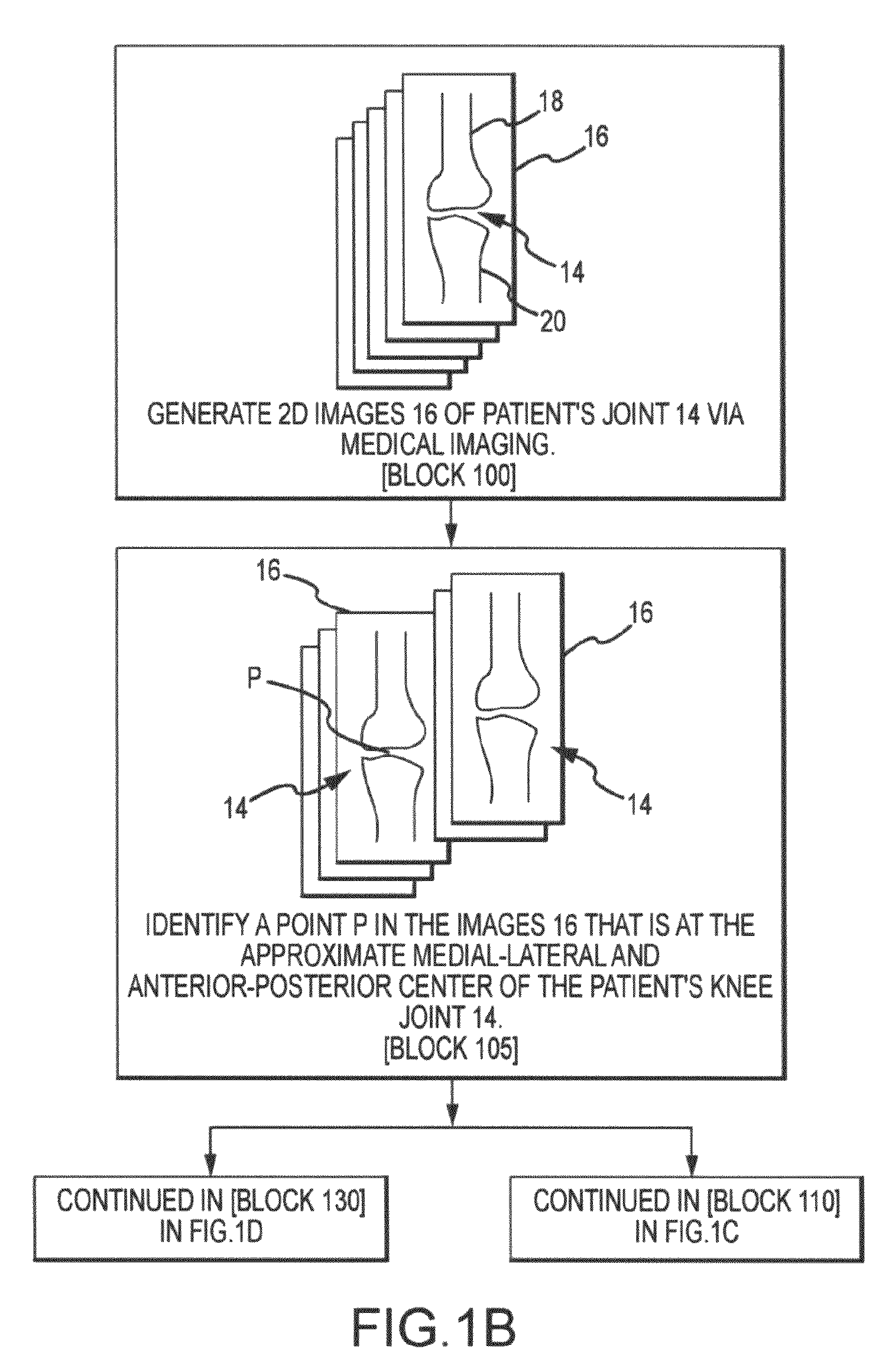 System and method for image segmentation in generating computer models of a joint to undergo arthroplasty