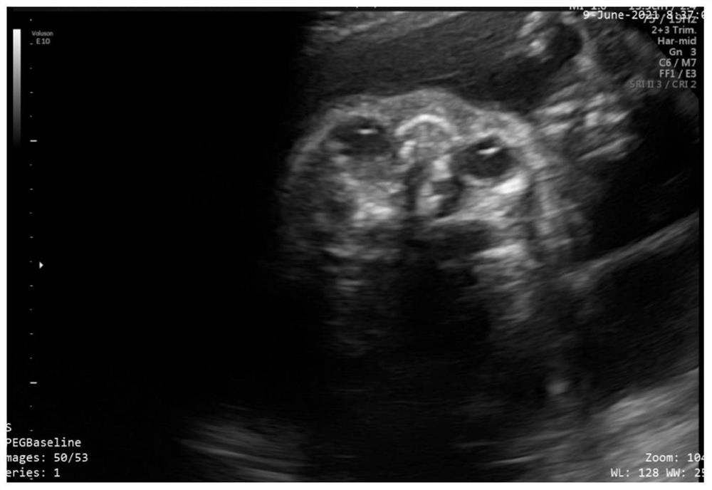 Method for intelligently acquiring bone structure parameters of fetal face and terminal equipment